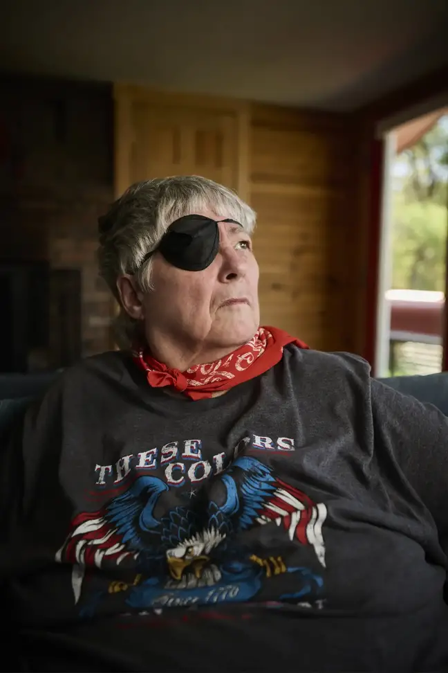 Patient Kathy Ryan at home shows her eyepatch